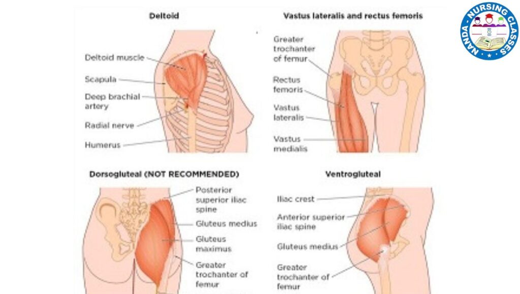 Intramuscular injection, Intramuscular injection procedure, intramuscular injection, im injection, injection, intramuscular, intramuscular injection (drug administration route), intramuscular injections, injection site, intramuscular injection sites, intramuscular injection, intramuscular injection deltoid, deltoid intramuscular injection, sites of intramuscular injection, intramuscular injection animation, intramuscular injection technique, intramuscular injection procedure