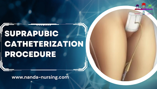 Suprapubic Catheterization : A Comprehensive Guide for Nursing Students