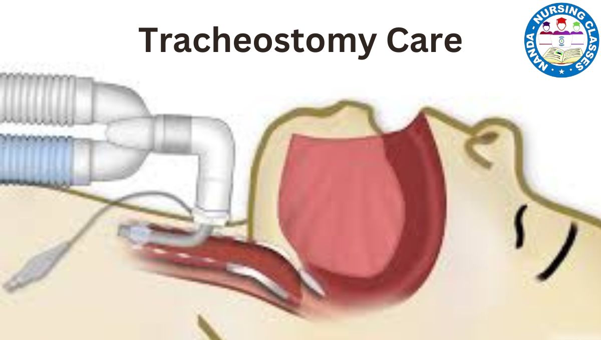 Tracheostomy Care, tracheostomy, tracheostomy care, tracheostomy tube, tracheostomy care and suctioning, tracheostomy care nursing, nursing tracheostomy care, tracheostomy supplies, tracheostomy training, tracheotomy, tracheostomy pre-procedure, why perform tracheostomy, tracheostomy care simplet nursing, how to perform tracheostomy, when to perform tracheostomy, what is a tracheostomy, tracheostomy vocalisation, national tracheostomy safety project, tracheostomy site care