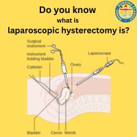 laparoscopic hysterectomy what to expect, what to know about hysterectomy recovery, what to expect after laparoscopic hysterectomy surgery, what is a hysterectomy, laparoscopic hysterectomy, laparoscopic hysterectomy story, laparoscopic hysterectomy video animation, laparoscopic hysterectomy recovery, laparoscopic hysterectomy post op care, recovery time for laparoscopic hysterectomy, laparoscopic hysterectomy recovery must haves, laparoscopic hysterectomy recovery stories