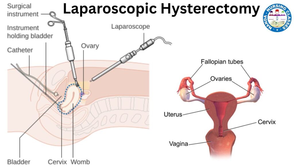 laparoscopic hysterectomy, total laparoscopic hysterectomy, laparoscopic hysterectomy in hyderabad, laparoscopic hysterectomy video animation, difficult total laparoscopic hysterectomy, laparoscopic hysterectomy recovery must haves, risks and complications laparoscopic hysterectomy, total :aparoscopic hysterectomy, total laparoscopic hyeterectomy, patient factors affect laparoscopic hysterectomy outcomes, laparoscopic myomectomy, robotic hysterectomy, laparoscopic techniques, laparoscopic, hysterectomy